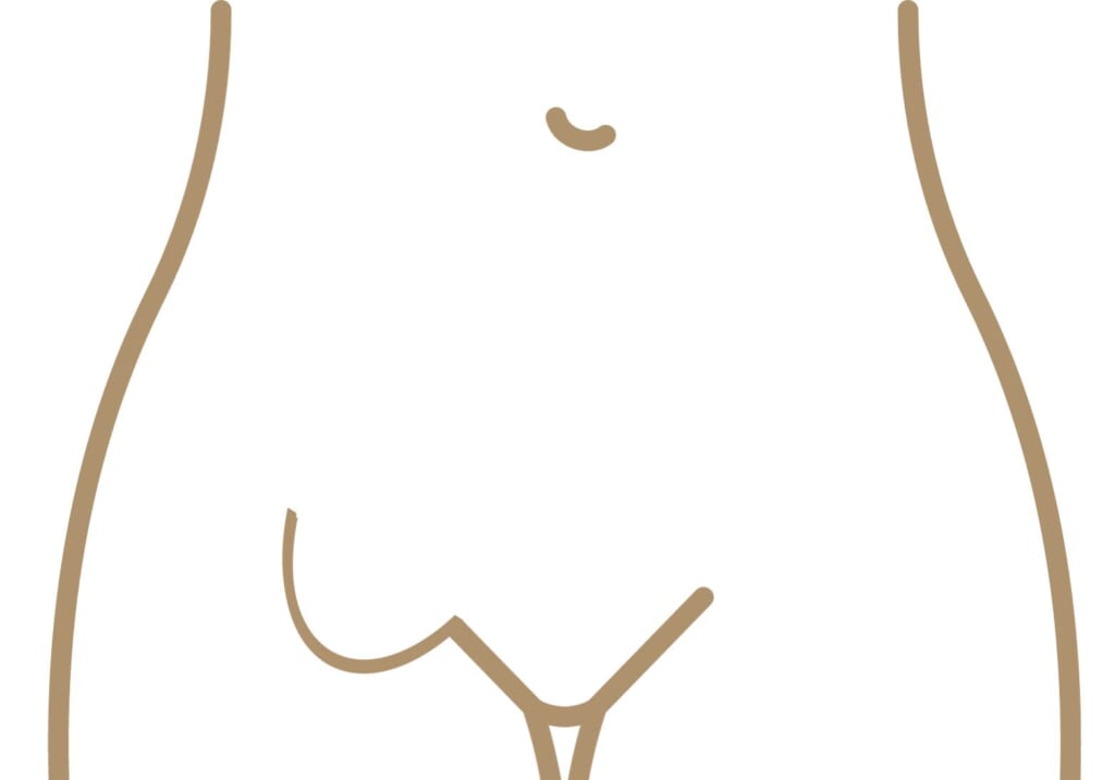 鼠径ヘルニア（脱腸）